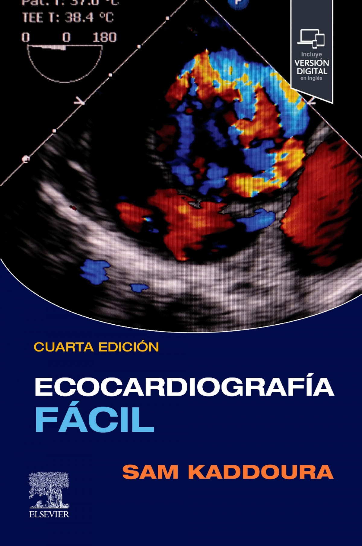 Ecocardiografia facil +student consult