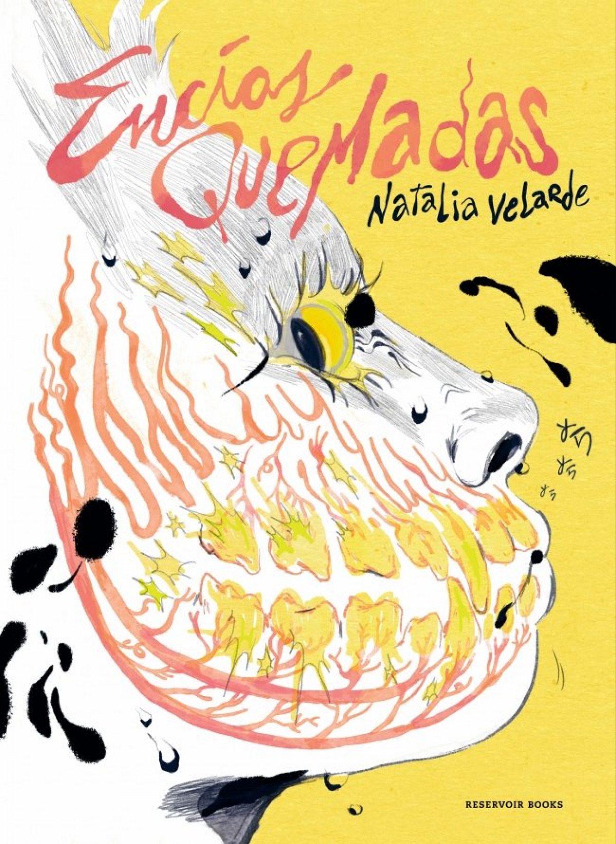 Encías quemadas