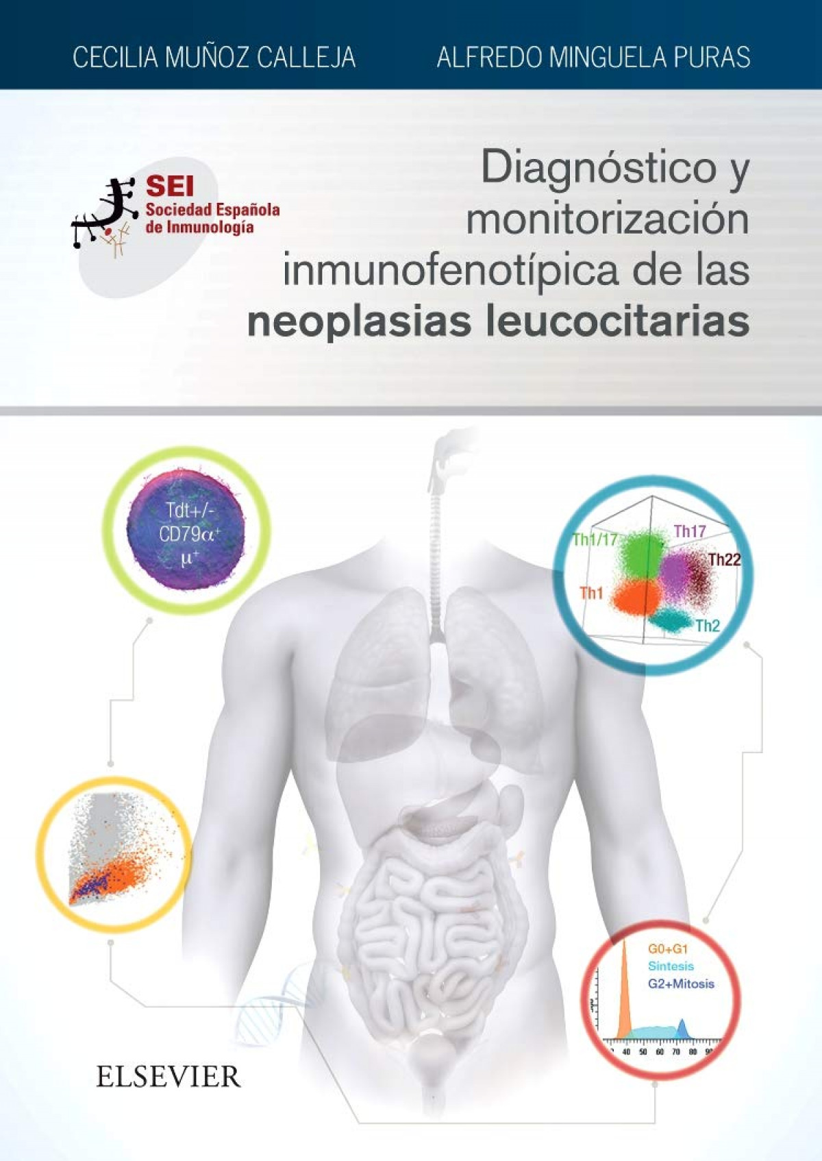 DIAGNÓSTICO Y MONITORIZACIÓN INMUNOFENOTÍPICA DE LAS NEOPLASIAS LEUCOCITARIAS