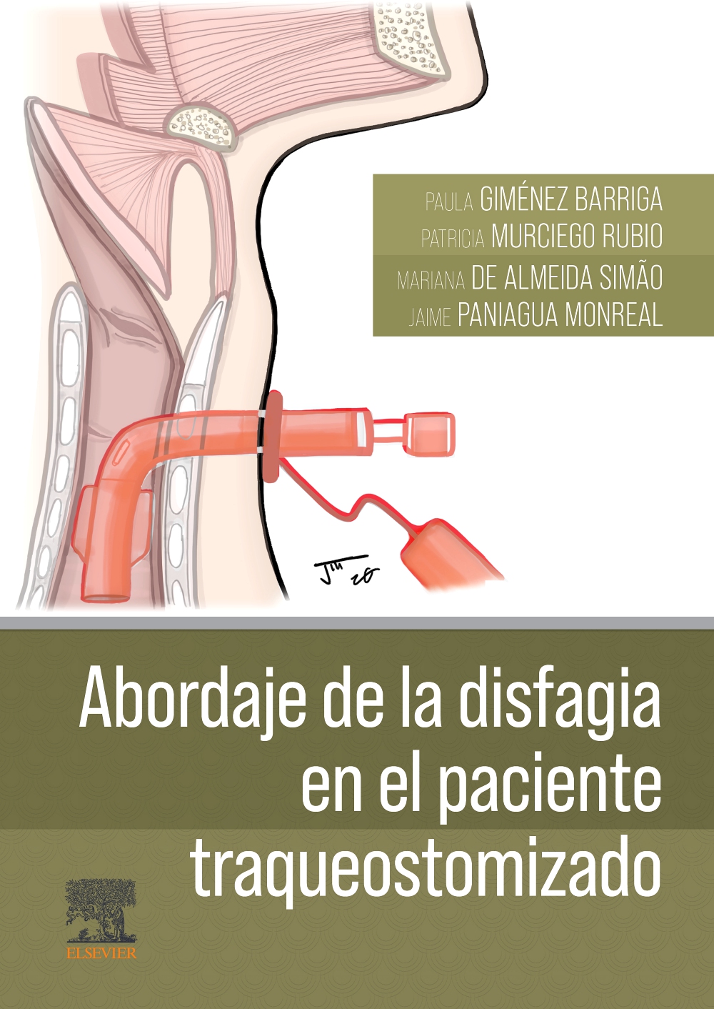 ABORDAJE DE LA DISFAGIA EN EL PACIENTE TRAQUEOSTOMIZADO